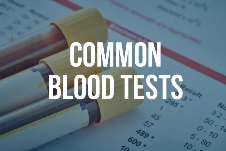 A close up of blood tests on top of a table