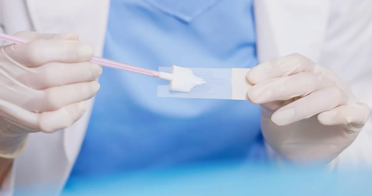 pap swab